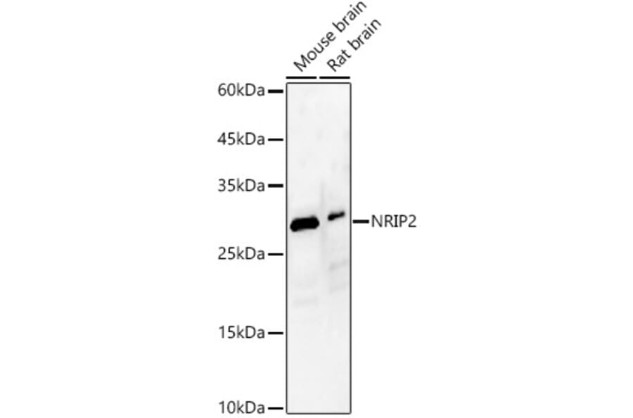 Western Blot - Anti-NRIP2 Antibody (A89215) - Antibodies.com