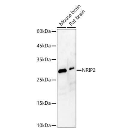Western Blot - Anti-NRIP2 Antibody (A89215) - Antibodies.com