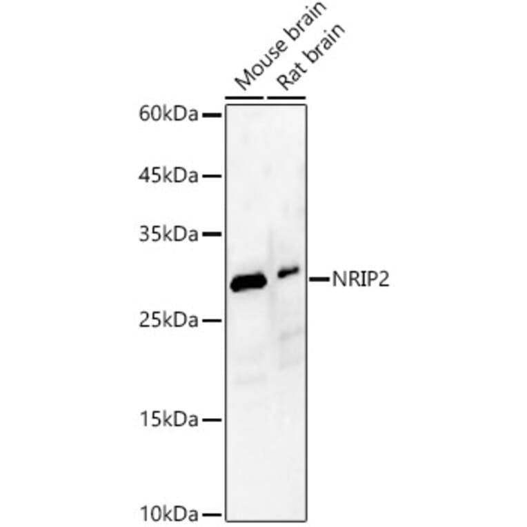 Western Blot - Anti-NRIP2 Antibody (A89215) - Antibodies.com