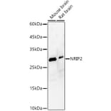 Western Blot - Anti-NRIP2 Antibody (A89215) - Antibodies.com