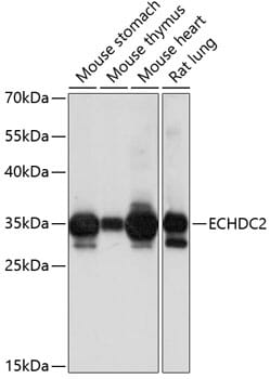 Western blot analysis of extracts of various cell lines, using Anti-ECHDC2 Antibody (A14591) at 1:1,000 dilution.
Secondary antibody: Goat Anti-Rabbit IgG (H+L) (HRP) (AS014) at 1:10,000 dilution.
Lysates / proteins: 25µg per lane.
Blocking buffer: 3% non-fat dry milk in TBST.
Detection: ECL Basic Kit (RM00020).
Exposure time: 32s.