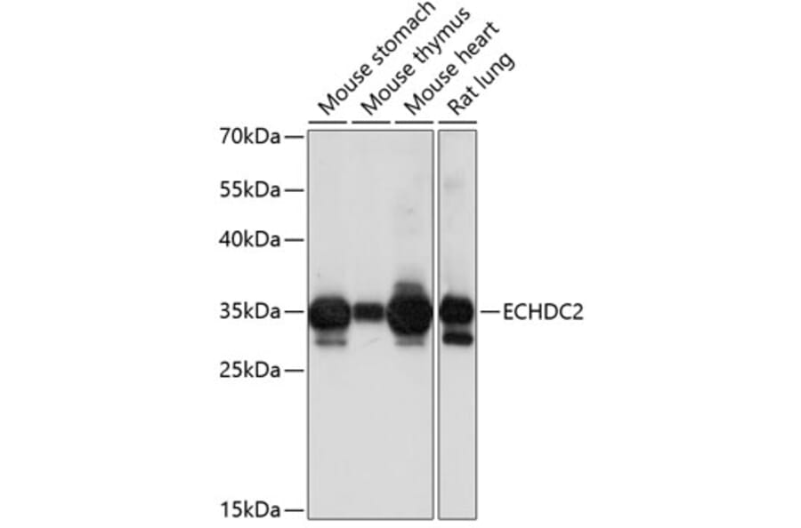 Western Blot - Anti-ECHDC2 Antibody (A89216) - Antibodies.com