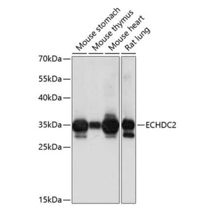 Western Blot - Anti-ECHDC2 Antibody (A89216) - Antibodies.com
