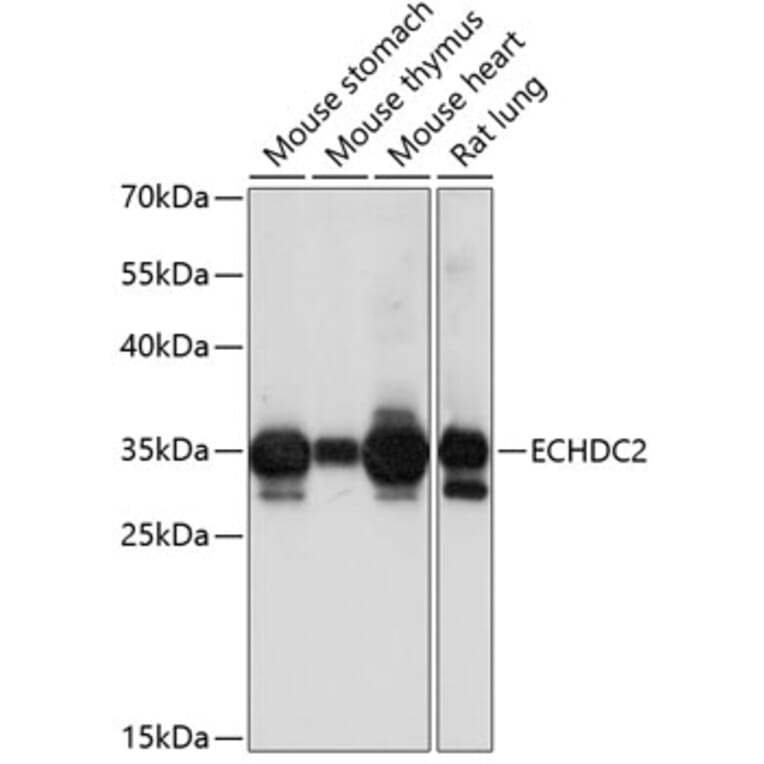Western Blot - Anti-ECHDC2 Antibody (A89216) - Antibodies.com