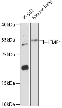 Western blot analysis of extracts of various cell lines, using Anti-LIME1 Antibody (A13719) at 1:3000 dilution.
Secondary antibody: Goat Anti-Rabbit IgG (H+L) (HRP) (AS014) at 1:10,000 dilution.
Lysates / proteins: 25µg per lane.
Blocking buffer: 3% non-fat dry milk in TBST.
Detection: ECL Basic Kit (RM00020).
Exposure time: 90s.