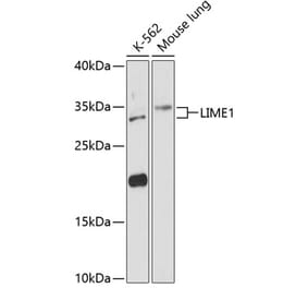 Western Blot - Anti-LIME Antibody (A89217) - Antibodies.com