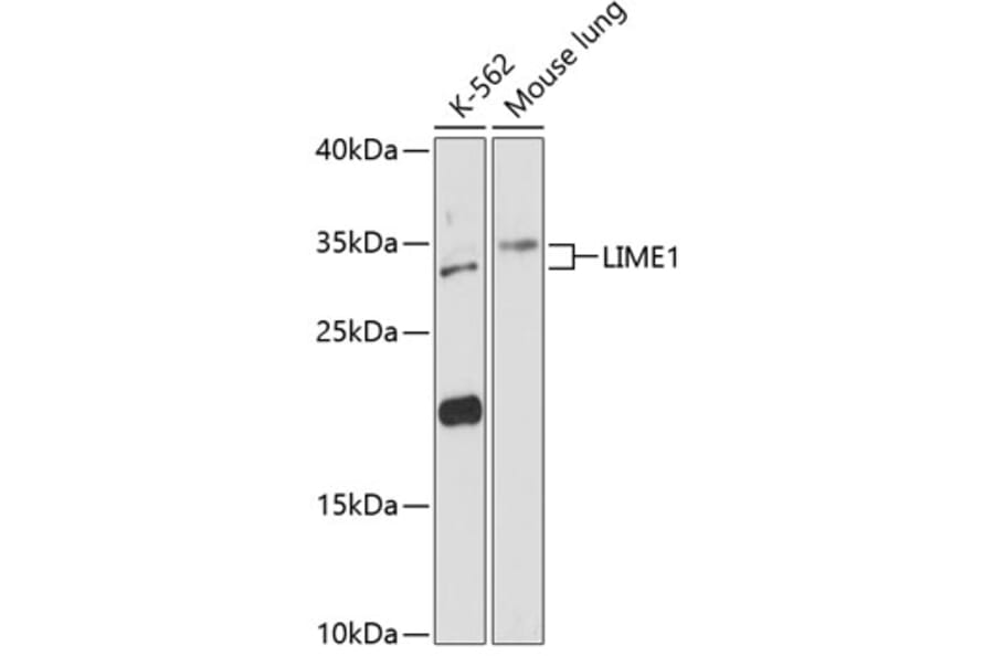 Western Blot - Anti-LIME Antibody (A89217) - Antibodies.com