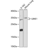Western Blot - Anti-LIME Antibody (A89217) - Antibodies.com