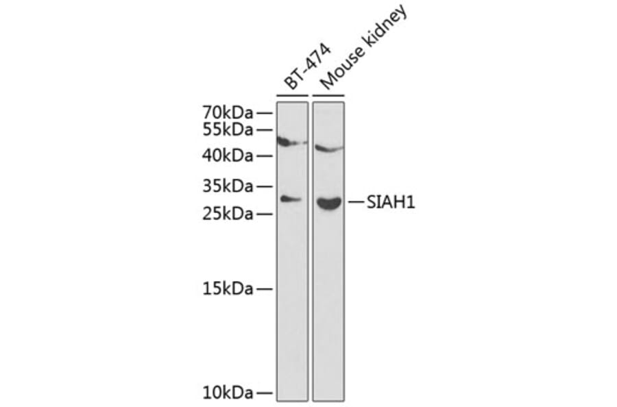 Western Blot - Anti-SIAH1 Antibody (A12490) - Antibodies.com