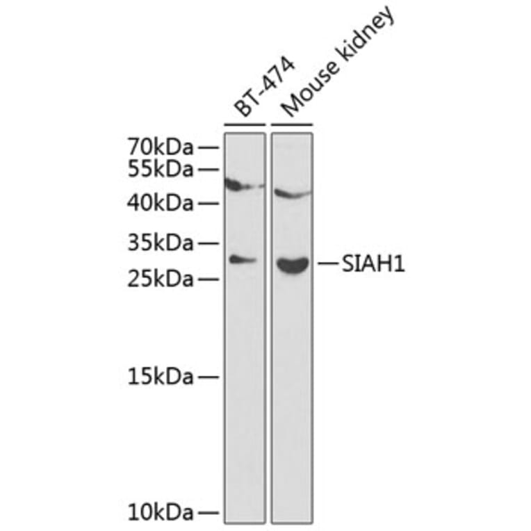 Western Blot - Anti-SIAH1 Antibody (A12490) - Antibodies.com