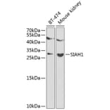 Western Blot - Anti-SIAH1 Antibody (A12490) - Antibodies.com