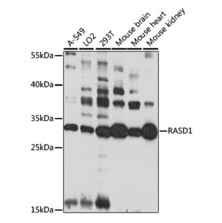 Western Blot - Anti-Dexras1 Antibody (A89219) - Antibodies.com