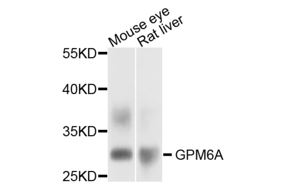 Western Blot - Anti-GPM6A Antibody (A12439) - Antibodies.com