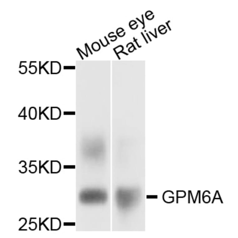 Western Blot - Anti-GPM6A Antibody (A12439) - Antibodies.com