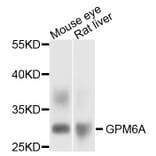Western Blot - Anti-GPM6A Antibody (A12439) - Antibodies.com