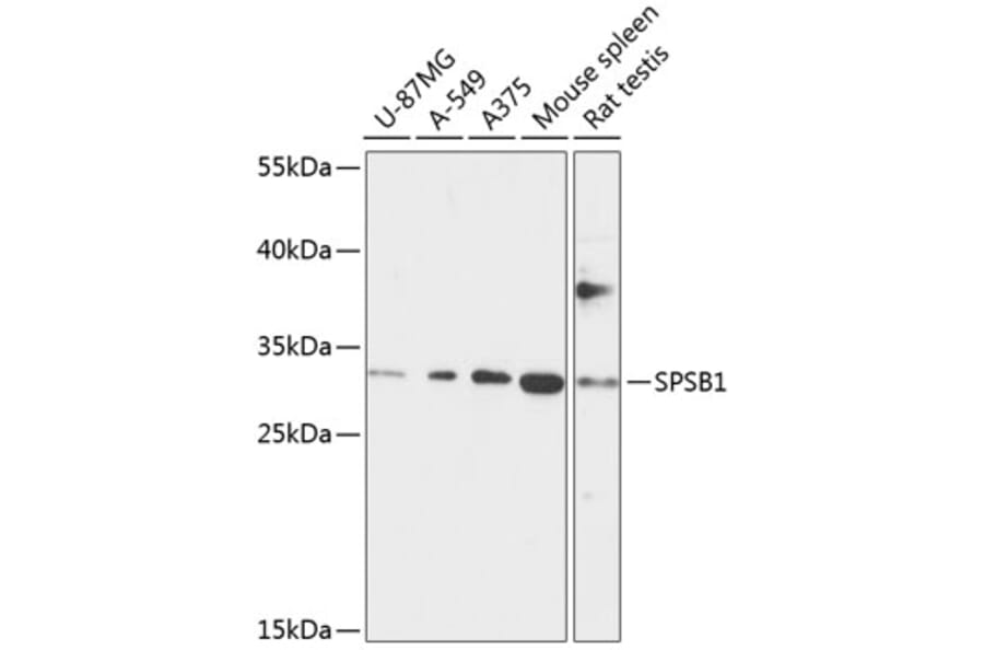 Western Blot - Anti-SSB-1 Antibody (A89221) - Antibodies.com