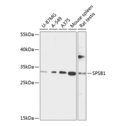Western Blot - Anti-SSB-1 Antibody (A89221) - Antibodies.com