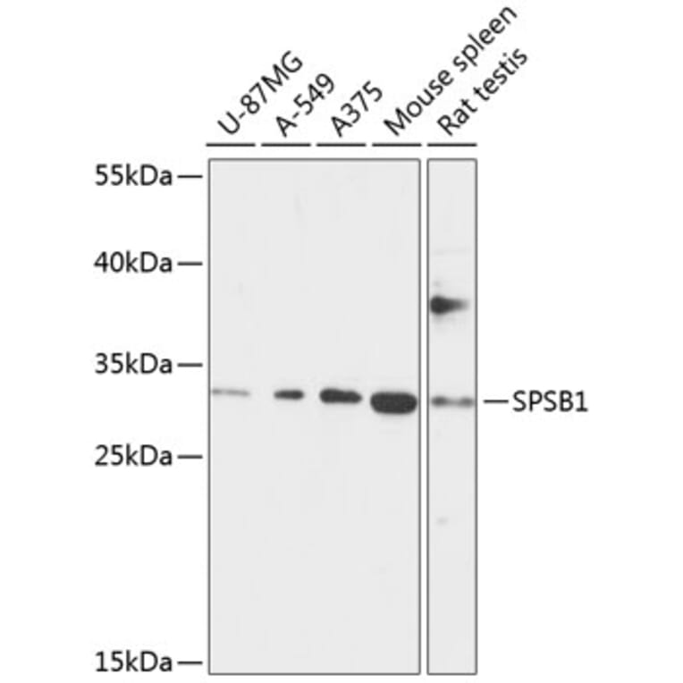 Western Blot - Anti-SSB-1 Antibody (A89221) - Antibodies.com