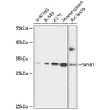 Western Blot - Anti-SSB-1 Antibody (A89221) - Antibodies.com