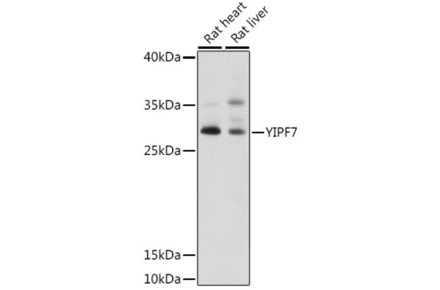 Western Blot - Anti-YIPF7 Antibody (A89222) - Antibodies.com