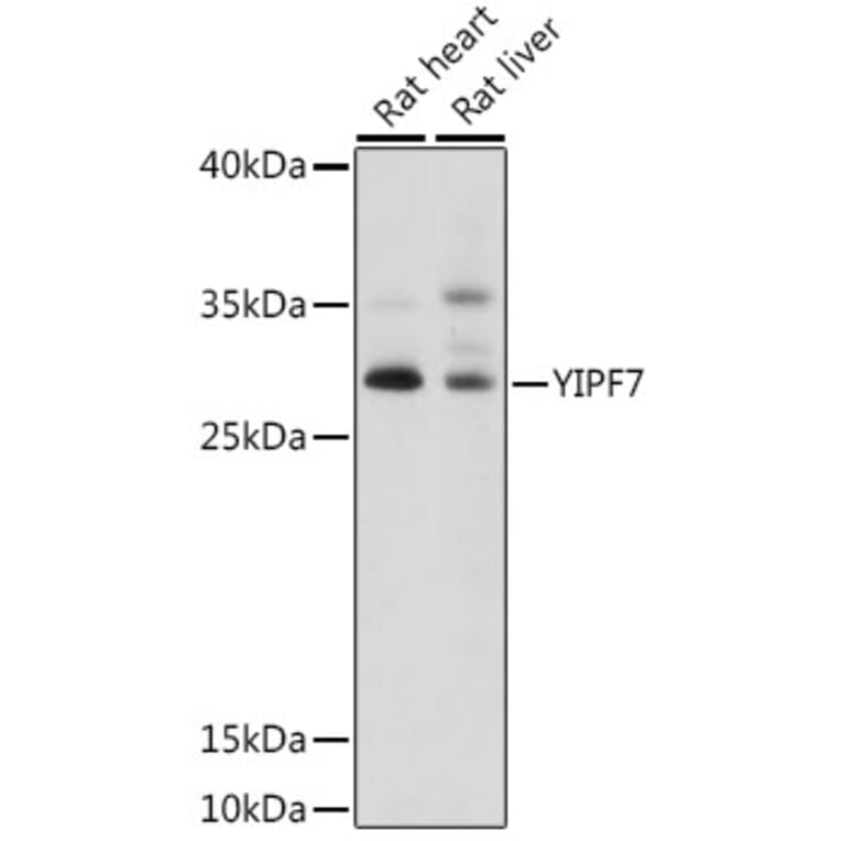 Western Blot - Anti-YIPF7 Antibody (A89222) - Antibodies.com