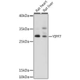 Western Blot - Anti-YIPF7 Antibody (A89222) - Antibodies.com