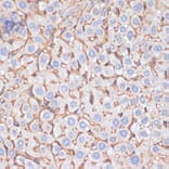 Immunohistochemistry - Anti-Apolipoprotein A I Antibody (A89224) - Antibodies.com