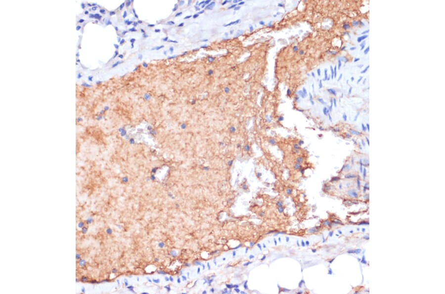 Immunohistochemistry - Anti-Apolipoprotein A I Antibody (A89224) - Antibodies.com