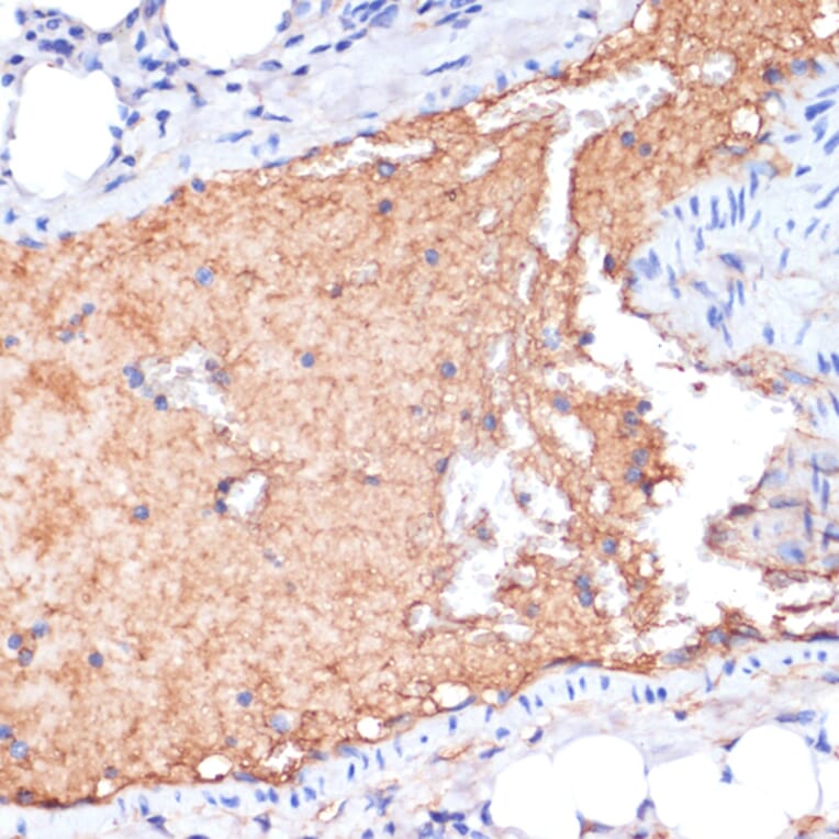 Immunohistochemistry - Anti-Apolipoprotein A I Antibody (A89224) - Antibodies.com