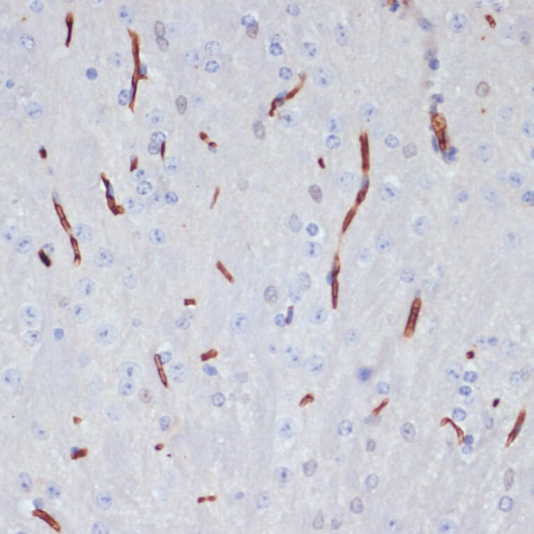 Immunohistochemistry - Anti-Apolipoprotein A I Antibody (A89224) - Antibodies.com