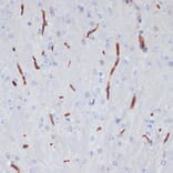 Immunohistochemistry - Anti-Apolipoprotein A I Antibody (A89224) - Antibodies.com