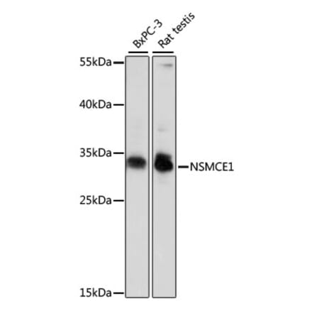 Western Blot - Anti-NSMCE1 Antibody (A89225) - Antibodies.com