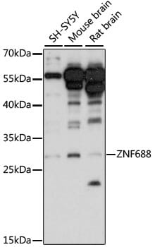 Western blot analysis of extracts of various cell lines, using Anti-ZNF688 Antibody (A15568) at 1:1,000 dilution.
Secondary antibody: Goat Anti-Rabbit IgG (H+L) (HRP) (AS014) at 1:10,000 dilution.
Lysates / proteins: 25µg per lane.
Blocking buffer: 3% non-fat dry milk in TBST.
Detection: ECL Basic Kit (RM00020).
Exposure time: 90s.