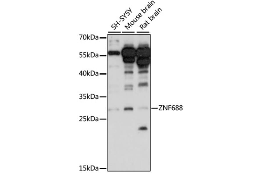 Western Blot - Anti-ZNF688 Antibody (A89226) - Antibodies.com