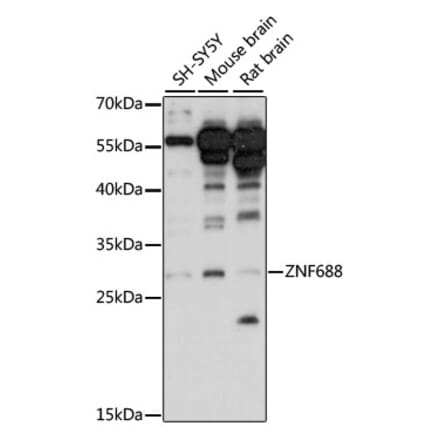 Western Blot - Anti-ZNF688 Antibody (A89226) - Antibodies.com