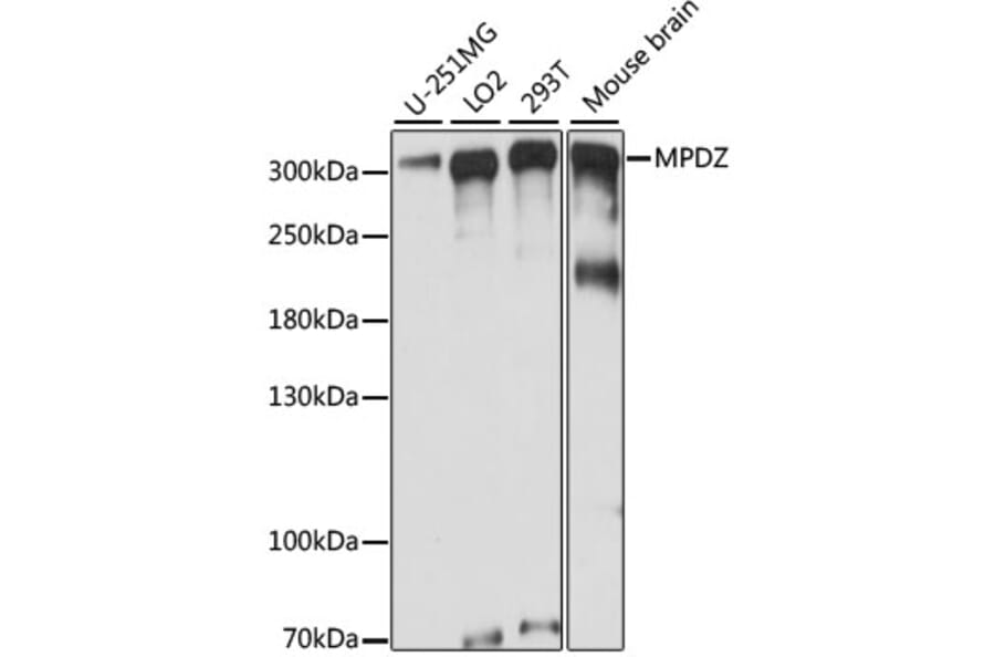 Western Blot - Anti-Mupp1 Antibody (A89227) - Antibodies.com