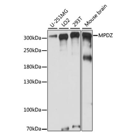 Western Blot - Anti-Mupp1 Antibody (A89227) - Antibodies.com