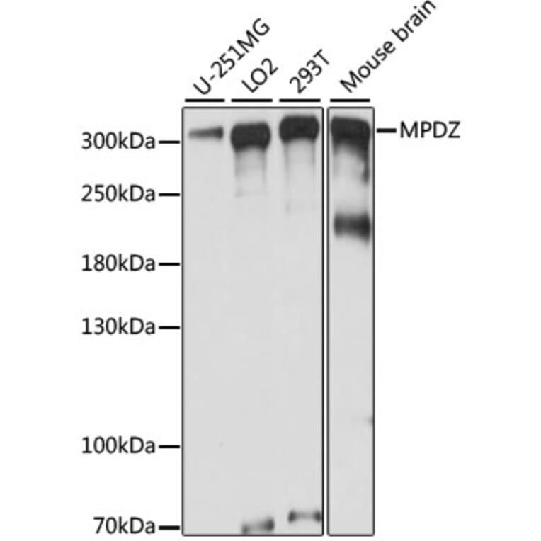Western Blot - Anti-Mupp1 Antibody (A89227) - Antibodies.com