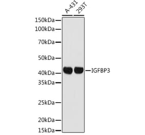 Western Blot - Anti-IGFBP3 Antibody (A89228) - Antibodies.com