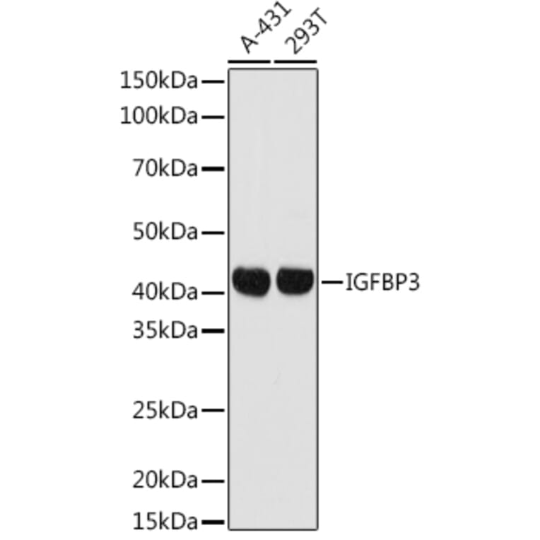 Western Blot - Anti-IGFBP3 Antibody (A89228) - Antibodies.com