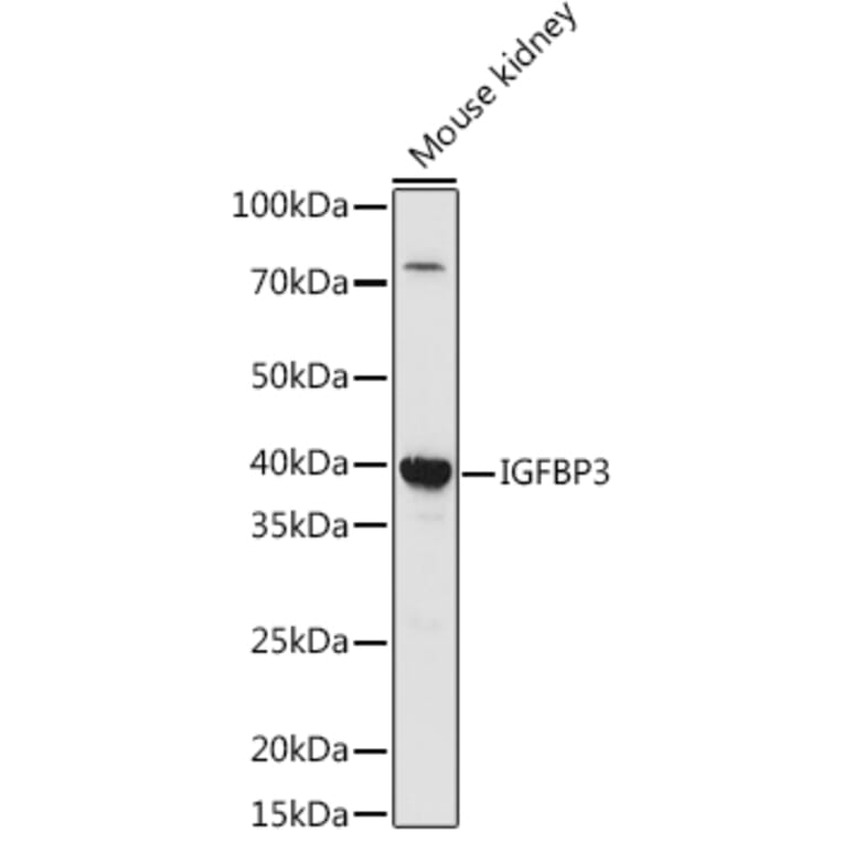 Western Blot - Anti-IGFBP3 Antibody (A89228) - Antibodies.com