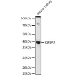 Western Blot - Anti-IGFBP3 Antibody (A89228) - Antibodies.com