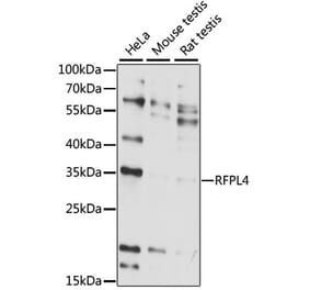 Western Blot - Anti-RFPL4A Antibody (A89229) - Antibodies.com