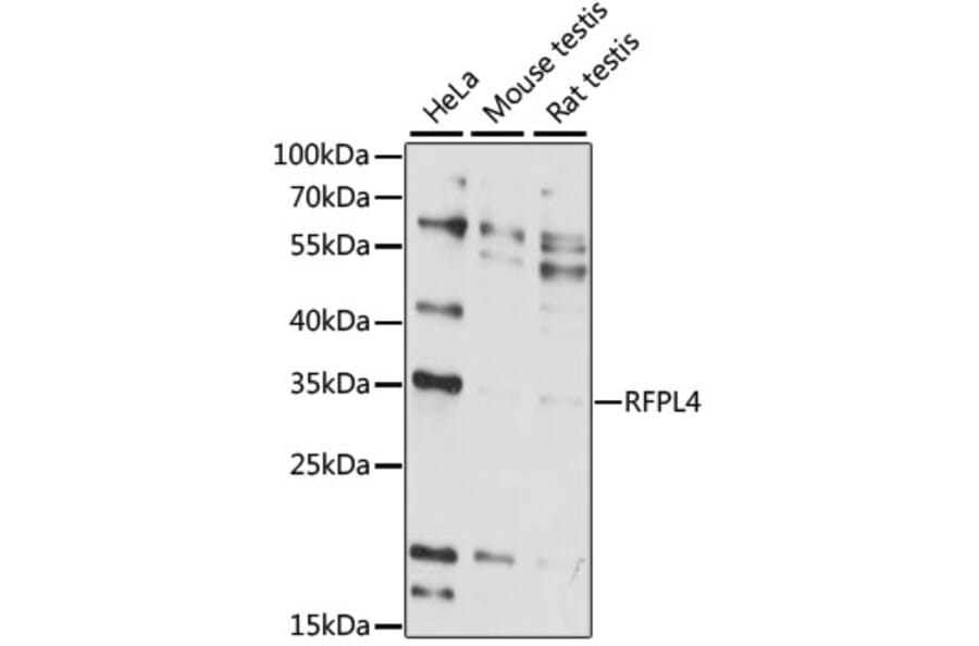 Western Blot - Anti-RFPL4A Antibody (A89229) - Antibodies.com