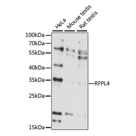 Western Blot - Anti-RFPL4A Antibody (A89229) - Antibodies.com