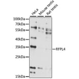 Western Blot - Anti-RFPL4A Antibody (A89229) - Antibodies.com