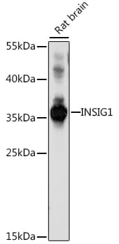 Western blot analysis of extracts of rat brain, using Anti-INSIG1 Antibody (A16278) at 1:1,000 dilution.
Secondary antibody: Goat Anti-Rabbit IgG (H+L) (HRP) (AS014) at 1:10,000 dilution.
Lysates / proteins: 25µg per lane.
Blocking buffer: 3% non-fat dry milk in TBST.
Detection: ECL Basic Kit (RM00020).
Exposure time: 150s.