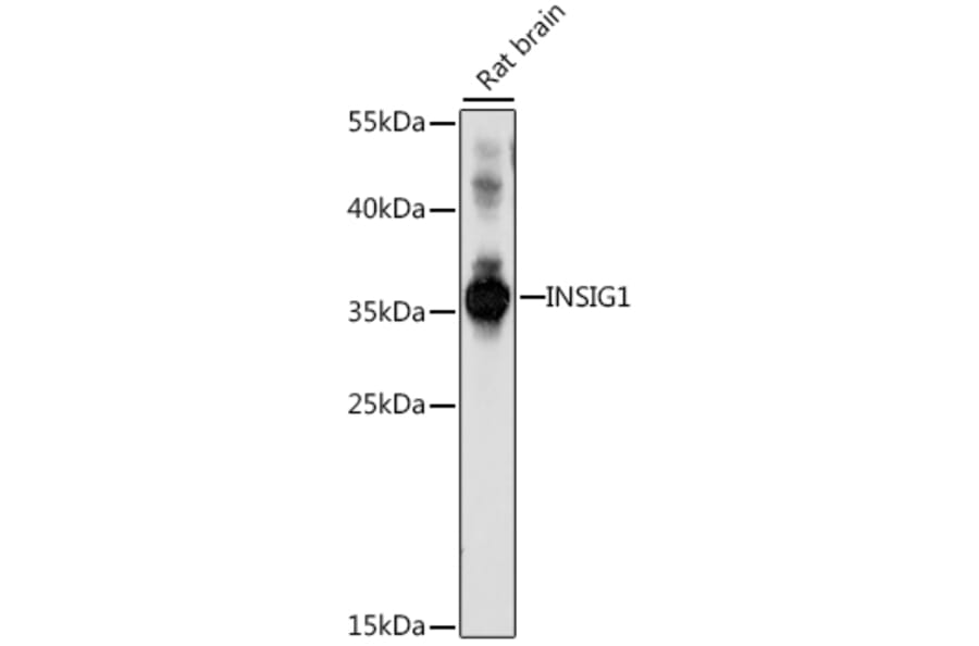 Western Blot - Anti-Insig1 Antibody (A89230) - Antibodies.com