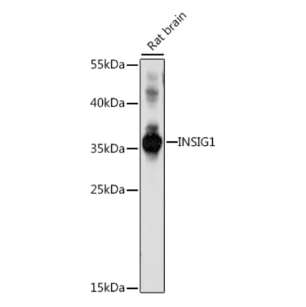 Western Blot - Anti-Insig1 Antibody (A89230) - Antibodies.com