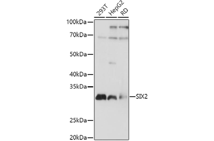 Western Blot - Anti-SIX2 Antibody (A89231) - Antibodies.com